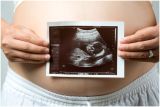 how to treat PCOS how to treat PCOS